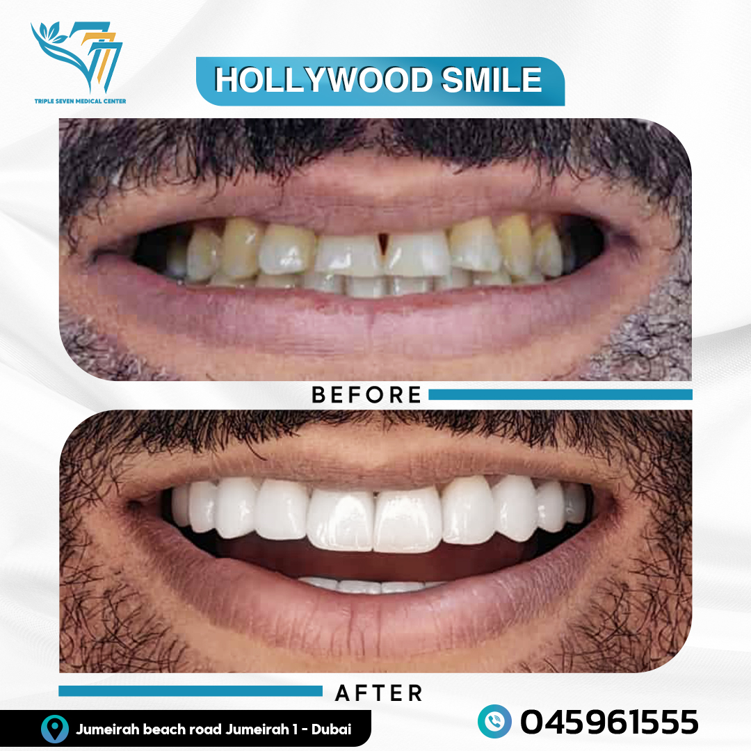 777 Clinic (Before and After) (6)