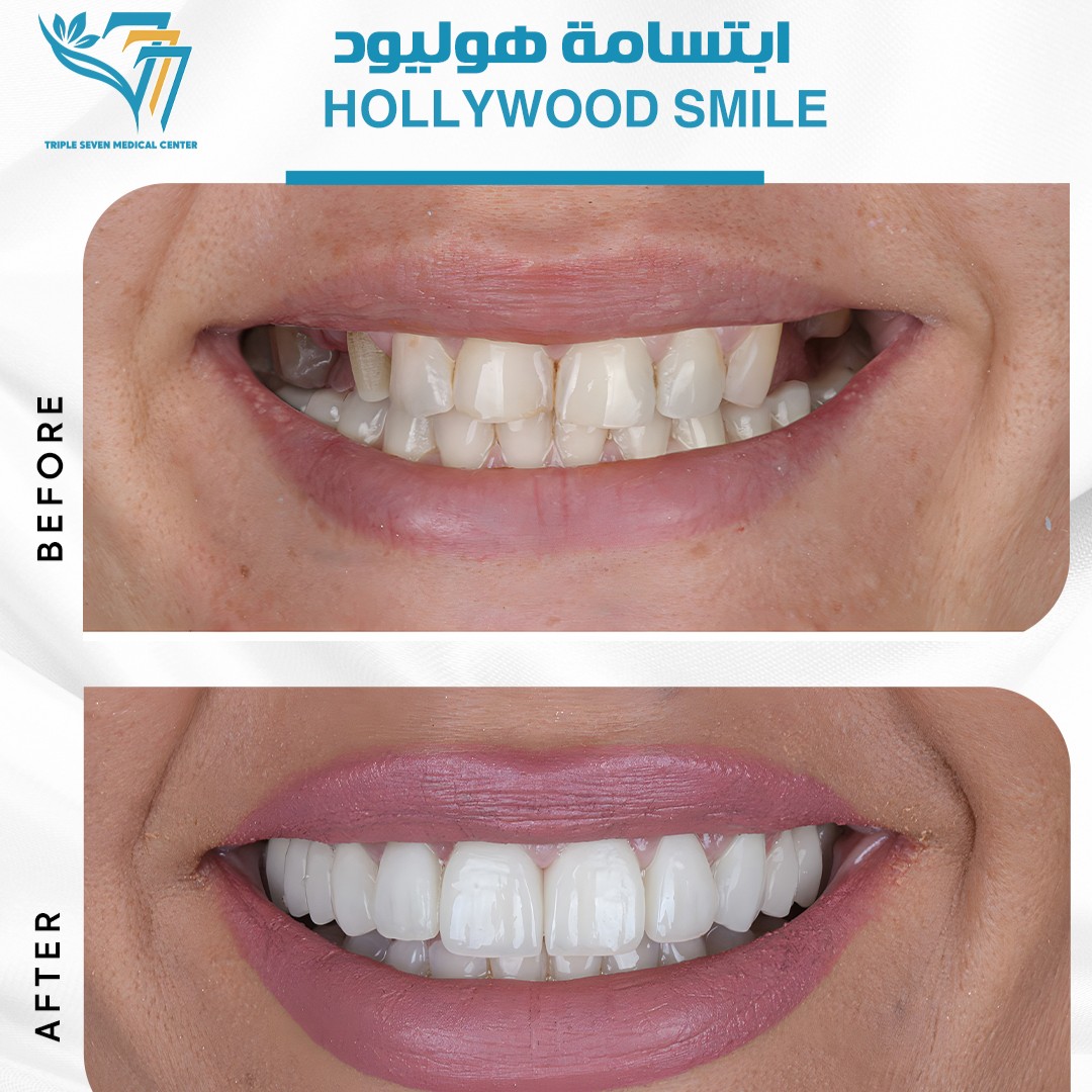 777 Clinic (Before and After) (9)
